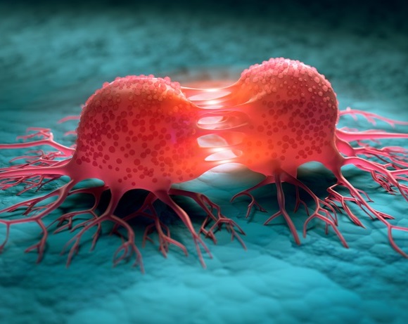 Image: The test aims to detect 12 of the most lethal and common cancers at an early stage (Photo courtesy of AdobeStock)